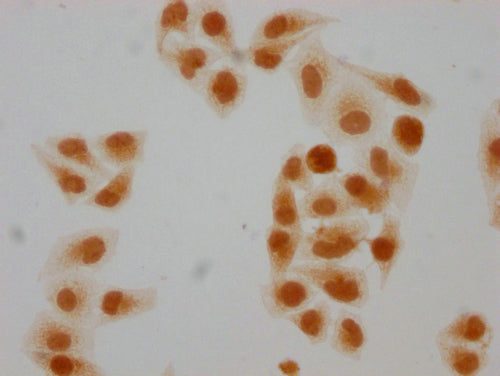 Immunocytochemistry analysis of CSB-PA010403PA108forHU diluted at 1:10 and staining in Hela cells(treated with 30mM sodium butyrate for 4h) performed on a Leica BondTM system. The cells were fixed in 4% formaldehyde, permeabilized using 0.2% Triton X-100 and blocked with 10% normal goat serum 30min at RT. Then primary antibody (1% BSA) was incubated at 4°C overnight. The primary is detected by a biotinylated secondary antibody and visualized using an HRP conjugated SP system.