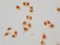 Immunocytochemistry analysis of CSB-PA010403PA23crHU diluted at 1:50 and staining in Hela cells(treated with 30mM sodium crotonylate for 4h) performed on a Leica BondTM system. The cells were fixed in 4% formaldehyde, permeabilized using 0.2% Triton X-100 and blocked with 10% normal goat serum 30min at RT. Then primary antibody (1% BSA) was incubated at 4°C overnight. The primary is detected by a biotinylated secondary antibody and visualized using an HRP conjugated SP system.
