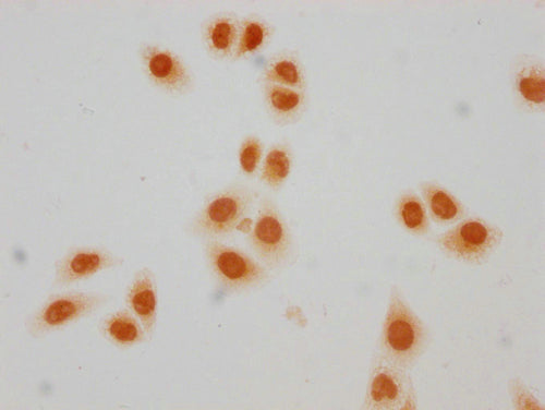 Immunocytochemistry analysis of CSB-PA010403PA23crHU diluted at 1:50 and staining in Hela cells(treated with 30mM sodium crotonylate for 4h) performed on a Leica BondTM system. The cells were fixed in 4% formaldehyde, permeabilized using 0.2% Triton X-100 and blocked with 10% normal goat serum 30min at RT. Then primary antibody (1% BSA) was incubated at 4°C overnight. The primary is detected by a biotinylated secondary antibody and visualized using an HRP conjugated SP system.