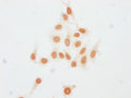 Immunocytochemistry analysis of CSB-PA010403PA23me1HU diluted at 1:15 and staining in Hela cells performed on a Leica BondTM system. The cells were fixed in 4% formaldehyde, permeabilized using 0.2% Triton X-100 and blocked with 10% normal goat serum 30min at RT. Then primary antibody (1% BSA) was incubated at 4°C overnight. The primary is detected by a biotinylated secondary antibody and visualized using an HRP conjugated SP system.