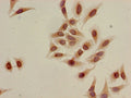 Immunocytochemistry analysis of Hela cells using CSB-PA010418OA09acHU at dilution of 1:100