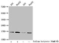 Western Blot
Detected samples: 293 whole cell lysate, HepG2 whole cell lysate; Untreated (-) or treated (+) with 30mM sodium butyrate for 4h
All lanes: HIST1H3A antibody at 1:2000
Secondary
Goat polyclonal to rabbit IgG at 1/50000 dilution
Predicted band size: 16 kDa
Observed band size: 16 kDa