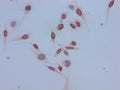 Immunocytochemistry analysis of Hela cells using CSB-PA010418OA14acHU at dilution of 1:100