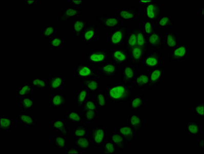 Immunofluorescence staining of Hela cells (treated with 30mM sodium butyrate for 4h) with CSB-PA010418OA14hibHU at 1:10, counter-stained with DAPI. The cells were fixed in 4% formaldehyde, permeabilized using 0.2% Triton X-100 and blocked in 10% normal Goat Serum. The cells were then incubated with the antibody overnight at 4&deg;C. The secondary antibody was Alexa Fluor 488-congugated AffiniPure Goat Anti-Rabbit IgG(H+L).