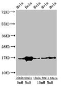 Western Blot
Positive WB detected in: Hela cell acid extracts treated by NaB
All lanes: HIST1H3A antibody at 1µg/ml
Secondary
Goat polyclonal to rabbit IgG at 1/50000 dilution
Predicted band size: 16 kDa
Observed band size: 16 kDa