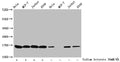 Western Blot
Detected samples: Hela whole cell lysate, MCF-7 whole cell lysate, Jurkat whole cell lysate, A549 whole cell lysate; Untreated (-) or treated (+) with 30mM sodium butyrate for 4h
All lanes: HIST1H3A antibody at 1:100
Secondary
Goat polyclonal to rabbit IgG at 1/40000 dilution
Predicted band size: 16 kDa
Observed band size: 16 kDa