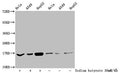 Western Blot
Detected samples: Hela whole cell lysate, A549 whole cell lysate, HepG2 whole cell lysate; Untreated (-) or treated (+) with 30mM sodium butyrate for 4h
All lanes: HIST1H3A antibody at 1:100
Secondary
Goat polyclonal to rabbit IgG at 1/50000 dilution
Predicted band size: 16 kDa
Observed band size: 16 kDa
