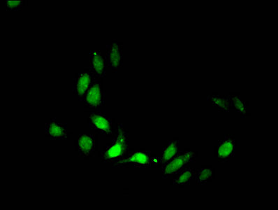 Immunofluorescent analysis of Hela cells treated with NaB using CSB-PA010418OA28acHU at dilution of 1:100 and Alexa Fluor 488-congugated AffiniPure Goat Anti-Rabbit IgG(H+L)