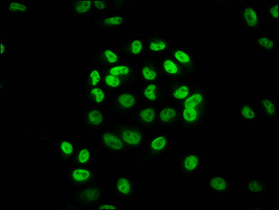 Immunofluorescence staining of Hela cells (treated with 30mM sodium butyrate for 4h) with CSB-PA010418OA36hibHU at 1:20, counter-stained with DAPI. The cells were fixed in 4% formaldehyde, permeabilized using 0.2% Triton X-100 and blocked in 10% normal Goat Serum. The cells were then incubated with the antibody overnight at 4&deg;C. The secondary antibody was Alexa Fluor 488-congugated AffiniPure Goat Anti-Rabbit IgG(H+L).
