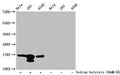 Western Blot
Detected samples: Hela whole cell lysate, 293 whole cell lysate, A549 whole cell lysate; Untreated (-) or treated (+) with 30mM sodium butyrate for 4h
All lanes: HIST1H3A antibody at 1:100
Secondary
Goat polyclonal to rabbit IgG at 1/50000 dilution
Predicted band size: 16 kDa
Observed band size: 16 kDa