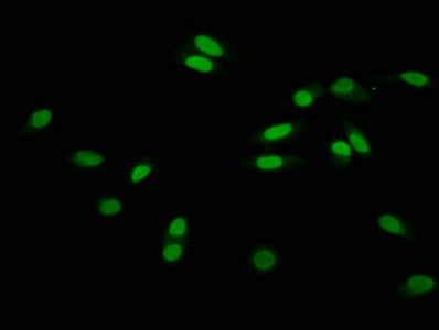 Immunofluorescence staining of Hela cells with CSB-PA010418OA56hibHU at 1:15, counter-stained with DAPI. The cells were fixed in 4% formaldehyde, permeabilized using 0.2% Triton X-100 and blocked in 10% normal Goat Serum. The cells were then incubated with the antibody overnight at 4&deg;C. The secondary antibody was Alexa Fluor 488-congugated AffiniPure Goat Anti-Rabbit IgG(H+L).