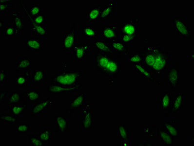 Immunofluorescence staining of Hela cells with CSB-PA010418OA64acHU at 1:5, counter-stained with DAPI. The cells were fixed in 4% formaldehyde, permeabilized using 0.2% Triton X-100 and blocked in 10% normal Goat Serum. The cells were then incubated with the antibody overnight at 4&deg;C. The secondary antibody was Alexa Fluor 488-congugated AffiniPure Goat Anti-Rabbit IgG(H+L).