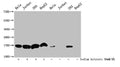 Western Blot
Detected samples: Hela whole cell lysate, Jurkat whole cell lysate, 293 whole cell lysate, HepG2 whole cell lysate; Untreated (-) or treated (+) with 30mM sodium butyrate for 4h
All lanes: HIST1H3A antibody at 1:500
Secondary
Goat polyclonal to rabbit IgG at 1/40000 dilution
Predicted band size: 16 kDa
Observed band size: 16 kDa