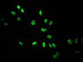 Immunofluorescent analysis of Hela cells treated by NaB using CSB-PA010418PA14acHU at dilution of 1:100 and Alexa Fluor 488-congugated AffiniPure Goat Anti-Rabbit IgG(H+L)