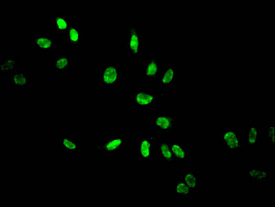 Immunofluorescent analysis of Hela cells treated by NaB using CSB-PA010418PA14acHU at dilution of 1:100 and Alexa Fluor 488-congugated AffiniPure Goat Anti-Rabbit IgG(H+L)