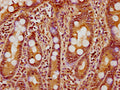 IHC image of CSB-PA010418PA18nhibHU diluted at 1:10 and staining in paraffin-embedded human small intestine tissue performed on a Leica BondTM system. After dewaxing and hydration, antigen retrieval was mediated by high pressure in a citrate buffer (pH 6.0). Section was blocked with 10% normal goat serum 30min at RT. Then primary antibody (1% BSA) was incubated at 4°C overnight. The primary is detected by a biotinylated secondary antibody and visualized using an HRP conjugated SP system.