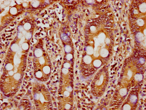 IHC image of CSB-PA010418PA18nhibHU diluted at 1:10 and staining in paraffin-embedded human small intestine tissue performed on a Leica BondTM system. After dewaxing and hydration, antigen retrieval was mediated by high pressure in a citrate buffer (pH 6.0). Section was blocked with 10% normal goat serum 30min at RT. Then primary antibody (1% BSA) was incubated at 4°C overnight. The primary is detected by a biotinylated secondary antibody and visualized using an HRP conjugated SP system.