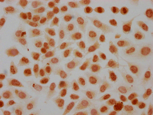 Immunocytochemistry analysis of CSB-PA010418PA41phHU diluted at 1:20 and staining in Hela cells(treated with 50nM Calyculin A for 30min) performed on a Leica BondTM system. The cells were fixed in 4% formaldehyde, permeabilized using 0.2% Triton X-100 and blocked with 10% normal goat serum 30min at RT. Then primary antibody (1% BSA) was incubated at 4°C overnight. The primary is detected by a biotinylated secondary antibody and visualized using an HRP conjugated SP system.