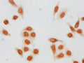 Immunocytochemistry analysis of CSB-PA010418PA79forHU diluted at 1:20 and staining in Hela cells(treated with 30mM sodium butyrate for 4h) performed on a Leica BondTM system. The cells were fixed in 4% formaldehyde, permeabilized using 0.2% Triton X-100 and blocked with 10% normal goat serum 30min at RT. Then primary antibody (1% BSA) was incubated at 4°C overnight. The primary is detected by a biotinylated secondary antibody and visualized using an HRP conjugated SP system.