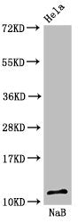 Western Blot
Positive WB detected in: Hela cell acid extracts treated by 15mM NaB for 60min
All lanes: HIST1H4A antibody at 1.6µg/ml
Secondary
Goat polyclonal to rabbit IgG at 1/50000 dilution
Predicted band size: 12 kDa
Observed band size: 12 kDa