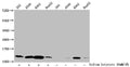 Western Blot
Detected samples: 293 whole cell lysate, A549 whole cell lysate, K562 whole cell lysate, HepG2 whole cell lysate; Untreated (-) or treated (+) with 30mM sodium butyrate for 4h
All lanes: HIST1H4A antibody at 1:2000
Secondary
Goat polyclonal to rabbit IgG at 1/40000 dilution
Predicted band size: 12 kDa
Observed band size: 12 kDa