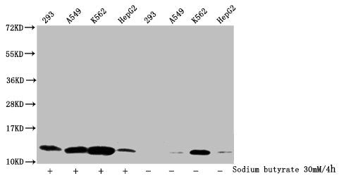 Western Blot
Detected samples: 293 whole cell lysate, A549 whole cell lysate, K562 whole cell lysate, HepG2 whole cell lysate; Untreated (-) or treated (+) with 30mM sodium butyrate for 4h
All lanes: HIST1H4A antibody at 1:2000
Secondary
Goat polyclonal to rabbit IgG at 1/40000 dilution
Predicted band size: 12 kDa
Observed band size: 12 kDa
