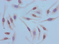 Immunocytochemistry analysis of Hela cells using CSB-PA010429OA12acHU at dilution of 1:100