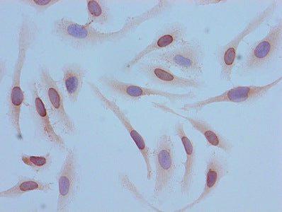 Immunocytochemistry analysis of Hela cells using CSB-PA010429OA12acHU at dilution of 1:100