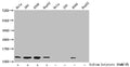 Western Blot
Detected samples: Hela whole cell lysate, 293 whole cell lysate, A549 whole cell lysate, HepG2 whole cell lysate; Untreated (-) or treated (+) with 30mM sodium butyrate for 4h
All lanes: HIST1H4A antibody at 1:2000
Secondary
Goat polyclonal to rabbit IgG at 1/40000 dilution
Predicted band size: 12 kDa
Observed band size: 12 kDa