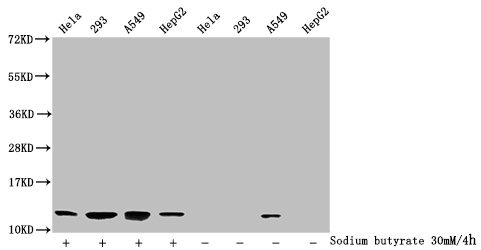 Western Blot
Detected samples: Hela whole cell lysate, 293 whole cell lysate, A549 whole cell lysate, HepG2 whole cell lysate; Untreated (-) or treated (+) with 30mM sodium butyrate for 4h
All lanes: HIST1H4A antibody at 1:2000
Secondary
Goat polyclonal to rabbit IgG at 1/40000 dilution
Predicted band size: 12 kDa
Observed band size: 12 kDa