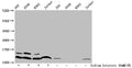 Western Blot
Detected samples: 293 whole cell lysate, A549 whole cell lysate, K562 whole cell lysate, Jurkat whole cell lysate; Untreated (-) or treated (+) with 30mM sodium butyrate for 4h
All lanes: HIST1H4A antibody at 1:100
Secondary
Goat polyclonal to rabbit IgG at 1/50000 dilution
Predicted band size: 12 kDa
Observed band size: 12 kDa