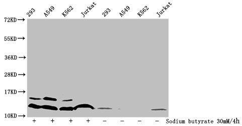 Western Blot
Detected samples: 293 whole cell lysate, A549 whole cell lysate, K562 whole cell lysate, Jurkat whole cell lysate; Untreated (-) or treated (+) with 30mM sodium butyrate for 4h
All lanes: HIST1H4A antibody at 1:100
Secondary
Goat polyclonal to rabbit IgG at 1/50000 dilution
Predicted band size: 12 kDa
Observed band size: 12 kDa