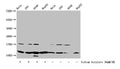 Western Blot
Detected samples: Hela whole cell lysate, 293 whole cell lysate, A549 whole cell lysate, HepG2 whole cell lysate; Untreated (-) or treated (+) with 30mM sodium butyrate for 4h
All lanes: HIST1H4A antibody at 1:100
Secondary
Goat polyclonal to rabbit IgG at 1/50000 dilution
Predicted band size: 12 kDa
Observed band size: 12 kDa