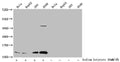 Western Blot
Detected samples: Hela whole cell lysate, HepG2 whole cell lysate, 293 whole cell lysate, A549 whole cell lysate; Untreated (-) or treated (+) with 30mM sodium butyrate for 4h
All lanes: HIST1H4A antibody at 1:1000
Secondary
Goat polyclonal to rabbit IgG at 1/40000 dilution
Predicted band size: 12 kDa
Observed band size: 12 kDa