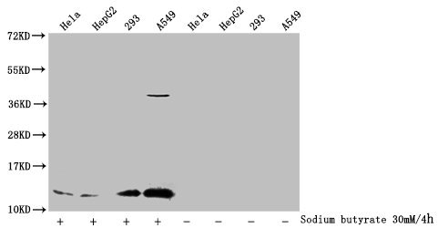 Western Blot
Detected samples: Hela whole cell lysate, HepG2 whole cell lysate, 293 whole cell lysate, A549 whole cell lysate; Untreated (-) or treated (+) with 30mM sodium butyrate for 4h
All lanes: HIST1H4A antibody at 1:1000
Secondary
Goat polyclonal to rabbit IgG at 1/40000 dilution
Predicted band size: 12 kDa
Observed band size: 12 kDa