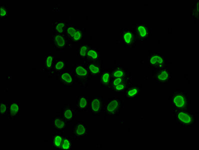 Immunofluorescence staining of Hela cells (treated with 30mM sodium butyrate for 4h) with CSB-PA010429OA91hibHU at 1:50, counter-stained with DAPI. The cells were fixed in 4% formaldehyde, permeabilized using 0.2% Triton X-100 and blocked in 10% normal Goat Serum. The cells were then incubated with the antibody overnight at 4&deg;C. The secondary antibody was Alexa Fluor 488-congugated AffiniPure Goat Anti-Rabbit IgG(H+L).