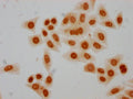 Immunocytochemistry analysis of CSB-PA010429PA05hibHU diluted at 1:50 and staining in Hela cells(treated with 30mM sodium butyrate for 4h) performed on a Leica BondTM system. The cells were fixed in 4% formaldehyde, permeabilized using 0.2% Triton X-100 and blocked with 10% normal goat serum 30min at RT. Then primary antibody (1% BSA) was incubated at 4°C overnight. The primary is detected by a biotinylated secondary antibody and visualized using an HRP conjugated SP system.