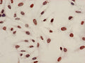 Acetyl-HIST1H4A (K8) Antibody – Figure 1 of 3