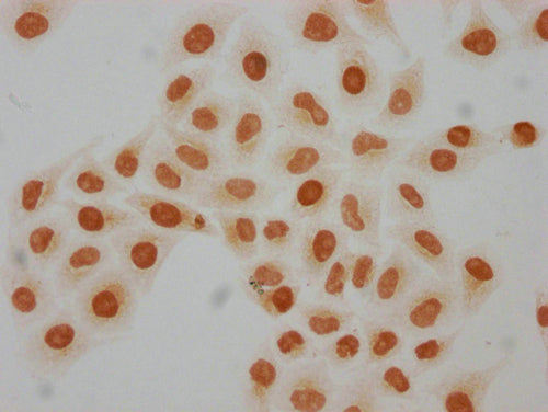 Immunocytochemistry analysis of CSB-PA010429PA08hibHU diluted at 1:50 and staining in Hela cells(treated with 30mM sodium butyrate for 4h) performed on a Leica BondTM system. The cells were fixed in 4% formaldehyde, permeabilized using 0.2% Triton X-100 and blocked with 10% normal goat serum 30min at RT. Then primary antibody (1% BSA) was incubated at 4°C overnight. The primary is detected by a biotinylated secondary antibody and visualized using an HRP conjugated SP system.