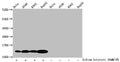Western Blot
Detected samples: Hela whole cell lysate, A549 whole cell lysate, K562 whole cell lysate, HepG2 whole cell lysate; Untreated (-) or treated (+) with 30mM sodium butyrate for 4h
All lanes: HIST1H4A antibody at 1.25µg/ml
Secondary
Goat polyclonal to rabbit IgG at 1/50000 dilution
Predicted band size: 12 kDa
Observed band size: 12 kDa