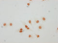 Immunocytochemistry analysis of CSB-PA010429PA59forHU diluted at 1:10 and staining in Hela cells(treated with 30mM sodium butyrate for 4h) performed on a Leica BondTM system. The cells were fixed in 4% formaldehyde, permeabilized using 0.2% Triton X-100 and blocked with 10% normal goat serum 30min at RT. Then primary antibody (1% BSA) was incubated at 4°C overnight. The primary is detected by a biotinylated secondary antibody and visualized using an HRP conjugated SP system.