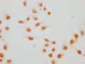 Immunocytochemistry analysis of CSB-PA010429PA59hibHU diluted at 1:20 and staining in Hela cells(treated with 30mM sodium butyrate for 4h) performed on a Leica BondTM system. The cells were fixed in 4% formaldehyde, permeabilized using 0.2% Triton X-100 and blocked with 10% normal goat serum 30min at RT. Then primary antibody (1% BSA) was incubated at 4°C overnight. The primary is detected by a biotinylated secondary antibody and visualized using an HRP conjugated SP system.