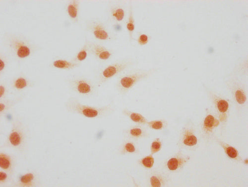 Immunocytochemistry analysis of CSB-PA010429PA59hibHU diluted at 1:20 and staining in Hela cells(treated with 30mM sodium butyrate for 4h) performed on a Leica BondTM system. The cells were fixed in 4% formaldehyde, permeabilized using 0.2% Triton X-100 and blocked with 10% normal goat serum 30min at RT. Then primary antibody (1% BSA) was incubated at 4°C overnight. The primary is detected by a biotinylated secondary antibody and visualized using an HRP conjugated SP system.