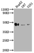 Western Blot
Positive WB detected in: HepG2 whole cell lysate, U87 whole cell lysate, U251 whole cell lysate
All lanes: HLA-G antibody at 1:2000
Secondary
Goat polyclonal to rabbit IgG at 1/50000 dilution
Predicted band size: 39, 28, 18, 37, 26, 14 kDa
Observed band size: 45 kDa