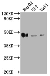 Western Blot
Positive WB detected in: HepG2 whole cell lysate, U87 whole cell lysate, U251 whole cell lysate
All lanes: HLA-G antibody at 1:2000
Secondary
Goat polyclonal to rabbit IgG at 1/50000 dilution
Predicted band size: 39, 28, 18, 37, 26, 14 kDa
Observed band size: 45 kDa