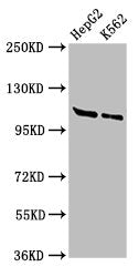 Western Blot
Positive WB detected in: HepG2 whole cell lysate, K562 whole cell lysate
All lanes: HLTF antibody at 3ug/ml
Secondary
Goat polyclonal to rabbit IgG at 1/50000 dilution
Predicted band size: 114, 100 kDa
Observed band size: 114 kDa