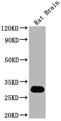 Western Blot
Positive WB detected in: Rat Brain tissue
All lanes: Hmgb1 antibody at 1:2000
Secondary
Goat polyclonal to rabbit IgG at 1/50000 dilution
Predicted band size: 25 kDa
Observed band size: 30 kDa