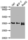 Western Blot
Positive WB detected in: U87 whole cell lysate, MCF-7 whole cell lysate, HepG2 whole cell lysate
All lanes: HMGCL antibody at 1:2000
Secondary
Goat polyclonal to rabbit IgG at 1/50000 dilution
Predicted band size: 35, 27, 21 kDa
Observed band size: 35 kDa