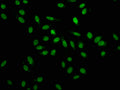 Immunofluorescence staining of Hela cells with CSB-PA010600HA01HU at 1:100, counter-stained with DAPI. The cells were fixed in 4% formaldehyde, permeabilized using 0.2% Triton X-100 and blocked in 10% normal Goat Serum. The cells were then incubated with the antibody overnight at 4&deg;C. The secondary antibody was Alexa Fluor 488-congugated AffiniPure Goat Anti-Rabbit IgG(H+L).