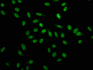 Immunofluorescence staining of Hela cells with CSB-PA010600HA01HU at 1:100, counter-stained with DAPI. The cells were fixed in 4% formaldehyde, permeabilized using 0.2% Triton X-100 and blocked in 10% normal Goat Serum. The cells were then incubated with the antibody overnight at 4&deg;C. The secondary antibody was Alexa Fluor 488-congugated AffiniPure Goat Anti-Rabbit IgG(H+L).